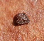 Spergulaire rouge Spergulaire rouge